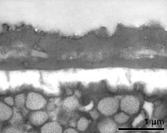 interapertural area of pollen wall