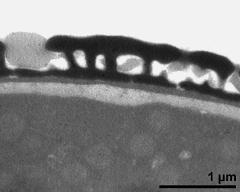 pollen wall; interapertural area; compact endexine clearly visible (electron-dense) with potassium permanganate