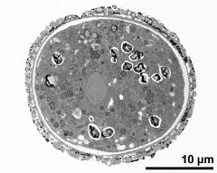 cross section of pollen grain