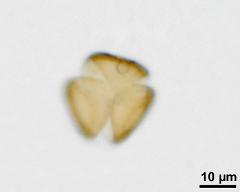 acetolyzed pollen,polar view,upper focus