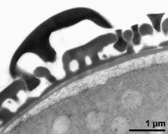 pollen wall; interapertural area; compact endexine clearly visible (electron-dense) with U + Pb