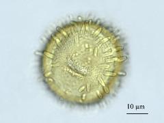 acetolyzed pollen,equatorial view