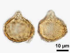 acetolyzed pollen,equatorial view