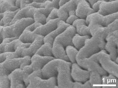 Sculpture in interapertural area