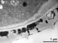 pollen wall, interapertural area