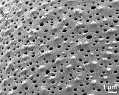 exine surface