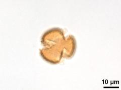 polar view,acetolyzed pollen