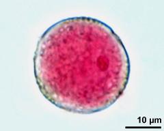 pollen grain with generative cell