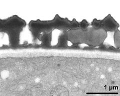 interapertural area of pollen wall