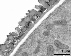 interapertural area of pollen wall