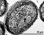 pollen grain in cross section