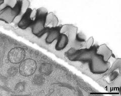 pollen wall, interapertural area