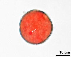 pollen grain with generative cell (arrow)