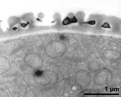 interapertural area of pollen wall