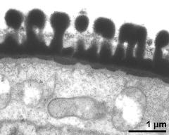 pollen wall, endexine clearly visible