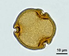 acetolyzed pollen,polar view