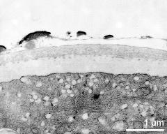 pollen wall of mature pollen grain; surface covered by pollenkitt