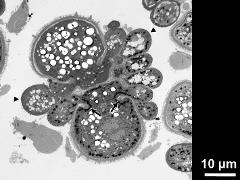 section of a tetrad, incomplete septum (arrows) in monads, cytoplasmic protrusions (arrowheads)