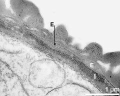 apertural area of pollen wall, intine (I), endexine (E)