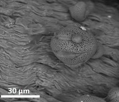 dry pollen,equatorial view