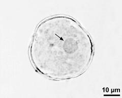 pollen grain with generative cell (arrow)