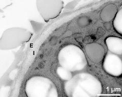 apertural area of pollen wall, intine (I), endexine (E)