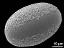distal polar view