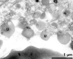 pollen wall (bottom) and tapetum cells with Ubisch bodies (U)