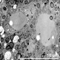 generative cell (left) and vegetative nucleus