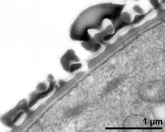 pollen wall, interapertural area, pollenkitt