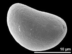 oblique proximal polar view