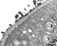 pollen wall at transition of aperture and interapertural area