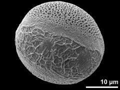 distal polar view