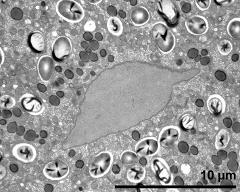 vegetative nucleus