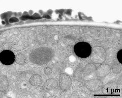 pollen wall at transition of aperture and interapertural area