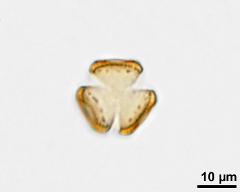 acetolysed pollen in polar view, upper focus