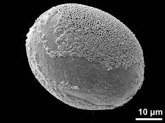 distal polar view