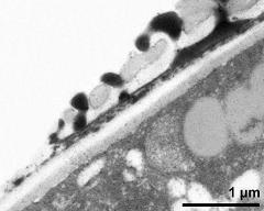 pollen wall at transition of aperture and interapertural area