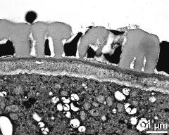 pollen wall, interapertural area