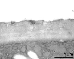 apertural area of pollen wall