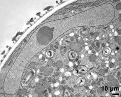 vegetative nucleus with nucleolus