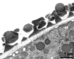 interapertural area of pollen wall