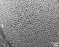 exine surface