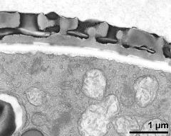 pollen wall, interapertural area