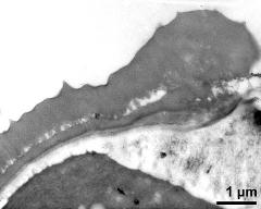 pollen wall at transition of aperture and interapertural area