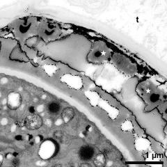 pollen wall and tapetum cells with Ubisch bodies (asterisks)