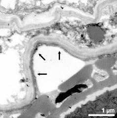 pollen wall and tapetum cells (arrows) without Ubisch bodies