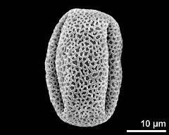 equatorial view (3-colpate pollen grain)