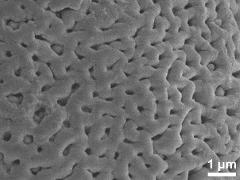 Sculpture in interapertural area