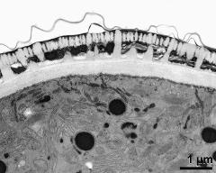 pollen wall, interapertural area